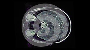 MRI brain scan, magnetic resonance image. CT scan of human brain in dynamic.