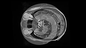 MRI brain scan, magnetic resonance image. CT scan of human brain in dynamic.