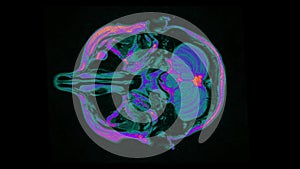 MRI brain scan, magnetic resonance image. CT scan of human brain in dynamic.