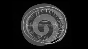 MRI brain scan, magnetic resonance image. CT scan of human brain in dynamic.