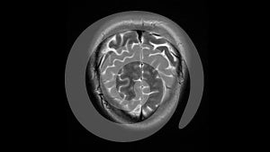 MRI brain scan, magnetic resonance image. CT scan of human brain in dynamic.