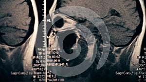 MRI brain scan or X-Ray imaging