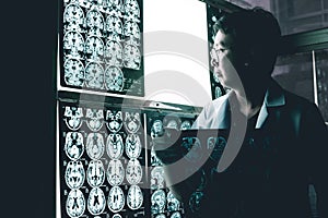 Dementia brain on MRI photo