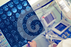 MRI in the hand of medical worker in the hospital ward