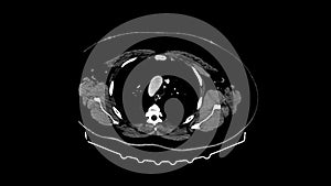 MRI of human illness analysis on magnetic resonance imaging sagittal view