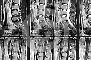 MRI image