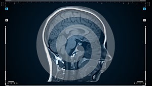 MRI scan of a human brain in motion. Scanning of brain magnetic resonance image. Diagnostic Medical Tool.