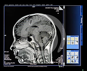 Mri Scan Monitor