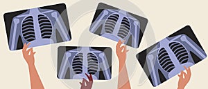 Mri scans lungs and fronchi, flat vector stock illustration with concept of computer tomogram or MRI, doctor`s hand and