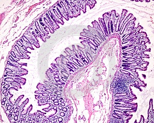 Mucosa of the human colon photo