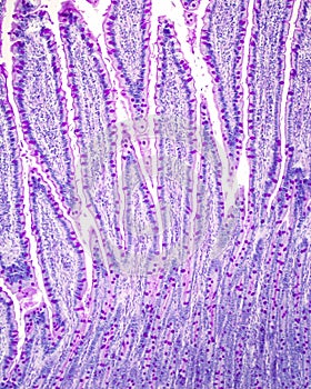 Intestinal epithelium. Goblet cells photo