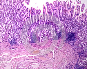 Human gastric mucosa. Pyloric antrum photo