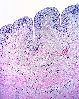 Urinary bladder mucosa photo