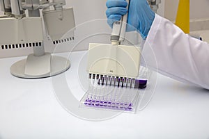 Multi channel pipette loading biological samples in microplate for test in the laboratory / Multichannel pipette load samples in