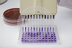 Multi channel pipette loading biological samples in microplate for test in the laboratory / Multichannel pipette load samples in