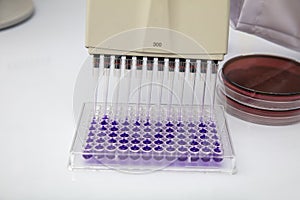 Multi channel pipette loading biological samples in microplate for test in the laboratory / Multichannel pipette load samples in