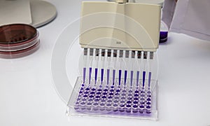 Multi channel pipette loading biological samples in microplate for test in the laboratory / Multichannel pipette load samples in