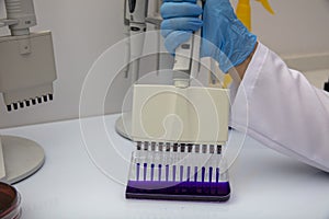 Multi channel pipette loading biological samples in microplate for test in the laboratory / Multichannel pipette load samples in