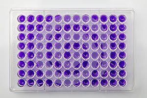 Multi channel pipette loading biological samples in microplate for test in the laboratory / Multichannel pipette load samples in