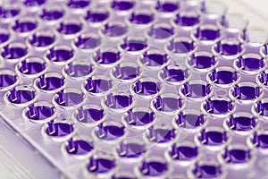 Multi channel pipette loading biological samples in microplate for test in the laboratory / Multichannel pipette load samples in