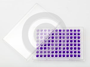 Multi channel pipette loading biological samples in microplate for test in the laboratory / Multichannel pipette load samples in