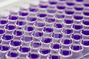 Multi channel pipette loading biological samples in microplate for test in the laboratory / Multichannel pipette load samples in