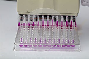 Multi channel pipette loading biological samples in microplate for test in the laboratory / Multichannel pipette load samples in