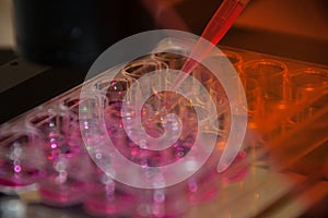 Multipette and multiwell tray experiment in the microbiology laboratory