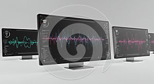 Multiple computer monitors displaying complex line graphs with a dark background