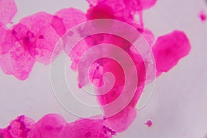 Multiple squamous epithelium under the microscope - Abstract pin