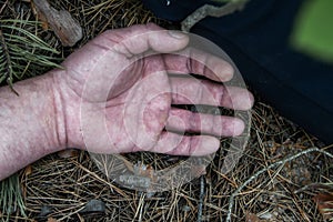 Murder in the woods. The hand of a dead man in the forest needles. Violent attack. Victim of crime