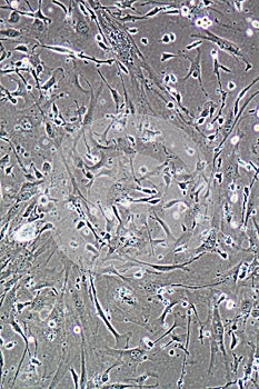 Muscle cells photo