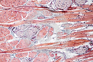 Muscle tissue