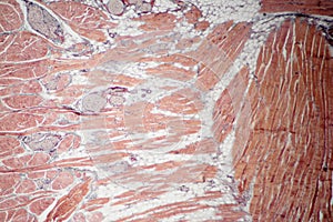 Muscle tissue