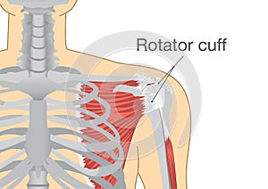 Muscles and tendons in shoulder is called Rotator Cuff. photo