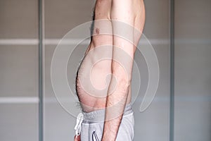 Muscular dystrophy of a man with a protrusion of the abdomen photo
