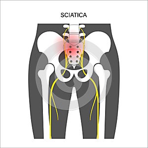 Muscular pelvis concept