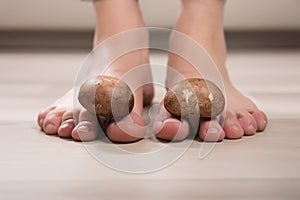 Mushrooms Between Woman`s Toes