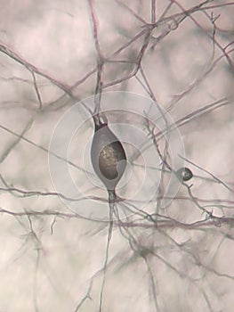 The mycelium of a dermatophyte fungus under the microscope