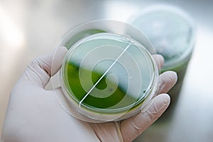 Mycelium selection, cultivation and reservation of mushrooms under laboratory conditions. Medical functional fungi in the modern