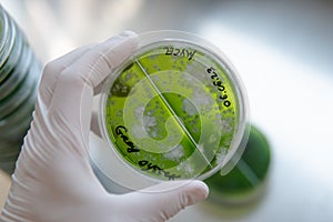 Mycelium selection, cultivation and reservation of mushrooms under laboratory conditions. Medical functional fungi in the modern