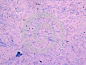 Histology of myelin and nissel substance in the brain LFB/CV photo
