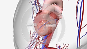 Myocardial ischemia is a condition that occurs when blood supply to the heart is reduced