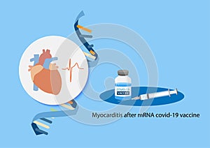 Myocarditis after mRNA covid-19 vaccination