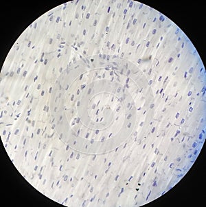 Myocardium photo