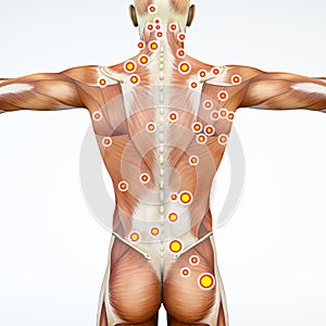 Back view of a man and his trigger points. Anatomy muscles. 3d rendering photo