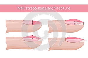 Nail care. The architecture of the nail stress zone, recovery. Illustration for a manual for manicure. Hand nail care .Vector