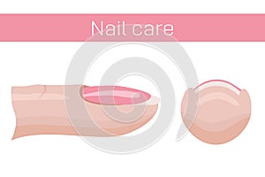 Nail care. Finger with nail, side and front view. Illustration for the manicure guide. Vector illustration photo