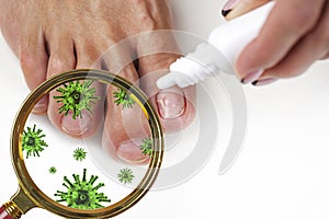 Nail care, treatment of nail fungus