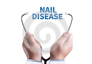 NAIL DISEASE Fungus Infection on Nails Hand, Finger with onycho